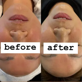 ✨ナリス化粧品✨ Shinyのエステ・リラクイメージ