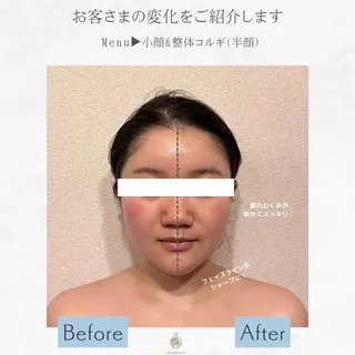 小顔Face Labo藤沢店所属・小顔フェイスラボ藤沢 山内萌香のエステ・リラクイメージ