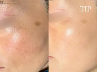 パーソナルスキンケア 🦋APRI🅿️有のエステ・リラクイメージ