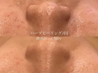 産後/ツヤ肌/子連れ /保育士在籍サロンのエステ・リラクイメージ