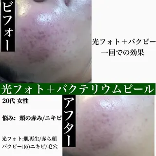 gratia ~ｸﾞﾚｲﾃｨｱ~のエステ・リラクイメージ