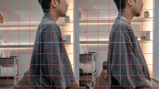 もりの木 整骨院＆整体院のエステ・リラクイメージ