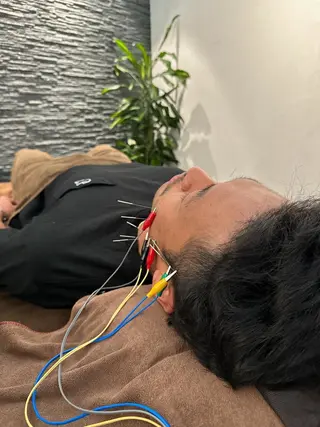小顔矯/美容鍼/鍼灸 BeauJuのその他イメージ