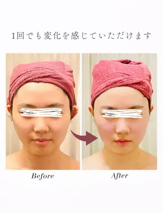 35歳からの エイジングケアサロンのエステ・リラクイメージ