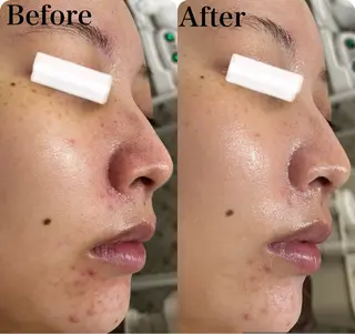 小顔&美肌品川店 Masqueradeのエステ・リラクイメージ