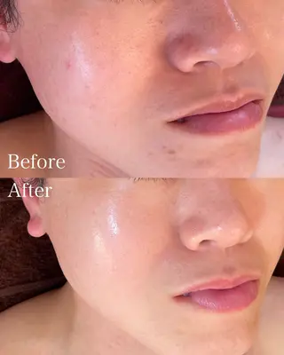 グリーンピール専門店 サロンY【大阪】のエステ・リラクイメージ