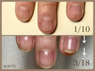 ネイル 自爪育成 warm AZUKI-アヅキ-のネイルデザイン