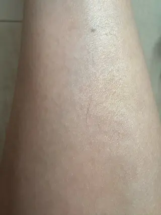 salon NOA所属・脱毛・ﾌｪｲｼｬﾙ 眉毛/山崎のエステ・リラクイメージ