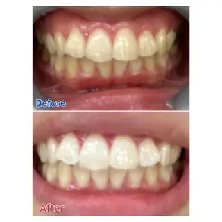 M渋谷 ホワイトニングのエステ・リラクイメージ