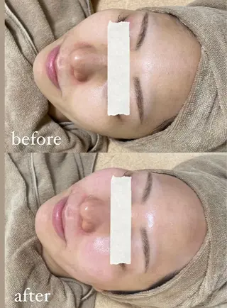 エステサロン Mi-mi.iのエステ・リラクイメージ