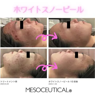 アドミーロ 🎀CHIKA🎀のエステ・リラクイメージ