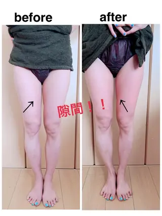 痩身/脱毛/ネイル HARUKAのエステ・リラクイメージ