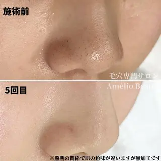 キッズ 毛穴ケア専門サロン アメリオボーテのその他イメージ
