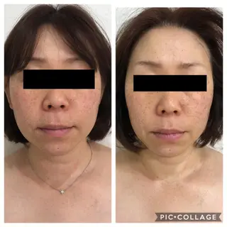 Gemmy 愛美のエステ・リラクイメージ