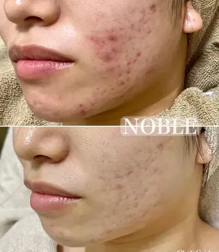 NOBLE 新宿本店のエステ・リラクイメージ