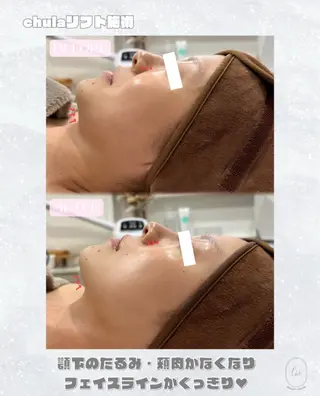 chulanail所属・natsumi .のエステ・リラクイメージ