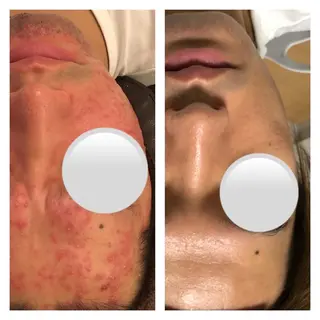 メンズ 朝重い人専用 肩甲骨調整のエステ・リラクイメージ