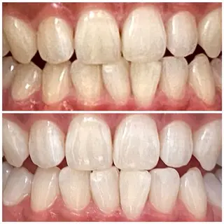 DIAMOND BEAUYのその他イメージ