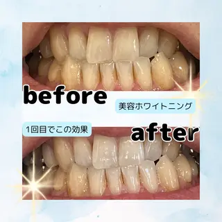 ホワイトニングサロン Soleilのその他イメージ