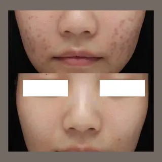 マツエク・マツパ 愛維美水光美肌専門店所属・愛維美水光美肌専門店 メンズレディースokのエステ・リラクイメージ