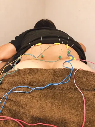 小顔矯/美容鍼/鍼灸 BeauJuのその他イメージ