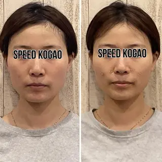 小顔矯正 natsuのエステ・リラクイメージ