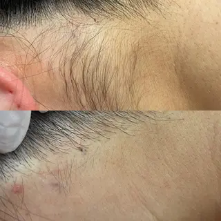 脱毛 シエスタ 山下 上級脱毛士のエステ・リラクイメージ