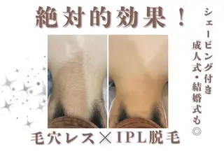 ヘアアレンジ U24限定クーポン レイビス池袋MANAのエステ・リラクイメージ