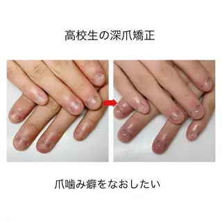 ネイル ネイルサロン アリュームのネイルデザイン