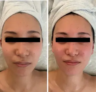 M.plus所属・水光韓国肌ハーブ ピーリングMplusのエステ・リラクイメージ