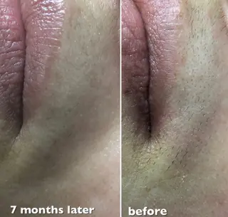 HIRAMORI E.T.Sのエステ・リラクイメージ