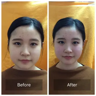 美容鍼×小顔矯正× 美容整体/小林幸司のエステ・リラクイメージ