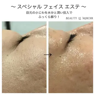 ビューティー ミロワールのエステ・リラクイメージ