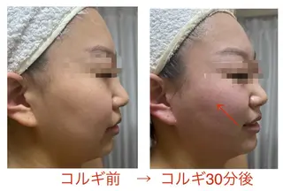 小顔コルギ10年 みなみ・池袋のエステ・リラクイメージ