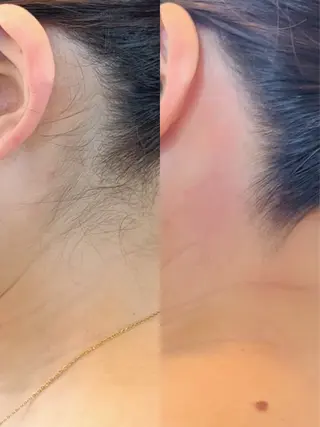 Hitomi シュガーリング豊橋のその他イメージ