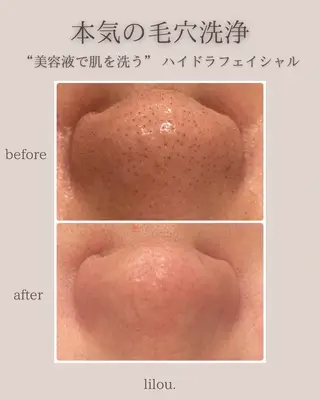 hue.所属・hue. YUKAのエステ・リラクイメージ