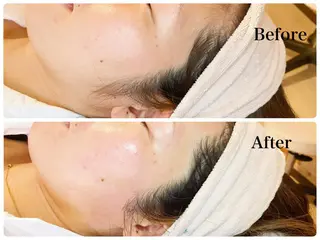 多摩境ViVi chinamiのエステ・リラクイメージ