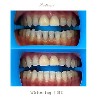 歯科医院提携 Retreatのエステ・リラクイメージ