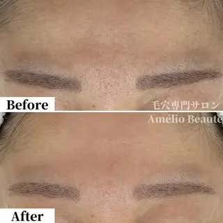 毛穴ケア専門サロン アメリオボーテのその他イメージ