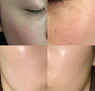 Queen Salonのエステ・リラクイメージ