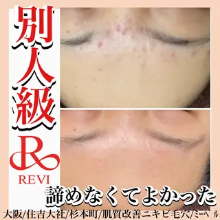 salon  mebell所属・肌管理専門店 mebell天王寺店のエステ・リラクイメージ