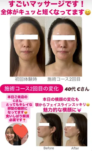 小顔サロン (ラ リュミエール)のエステ・リラクイメージ