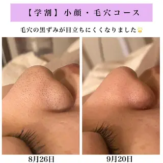 Bellesthe (ベルエステ)のエステ・リラクイメージ