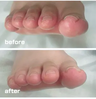 巻き爪フットケアサロンKotori所属・フットケアサロン Kotoriのその他イメージ