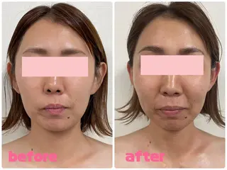 完全個室サロン Anjirのエステ・リラクイメージ