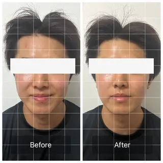 メンズ エマニエル USAのエステ・リラクイメージ