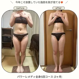 《本気痩せ×疲労改善 》  BILOOPのエステ・リラクイメージ