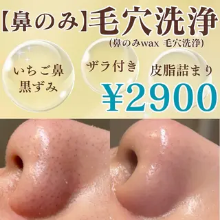 Lea堺東　毛穴洗浄 ×顔ワックス脱毛のその他イメージ