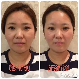 nano.face名古屋駅前店所属・美容鍼/小顔&整体 nano.faceのエステ・リラクイメージ