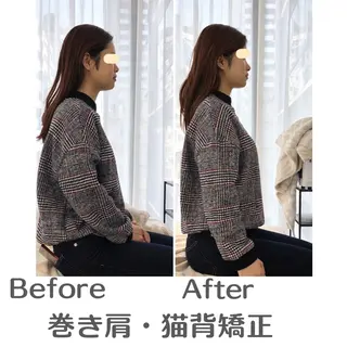巻き肩・猫背矯正 小顔　espoirのエステ・リラクイメージ